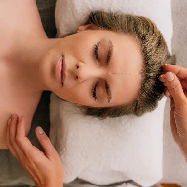 acupuncture service treatments